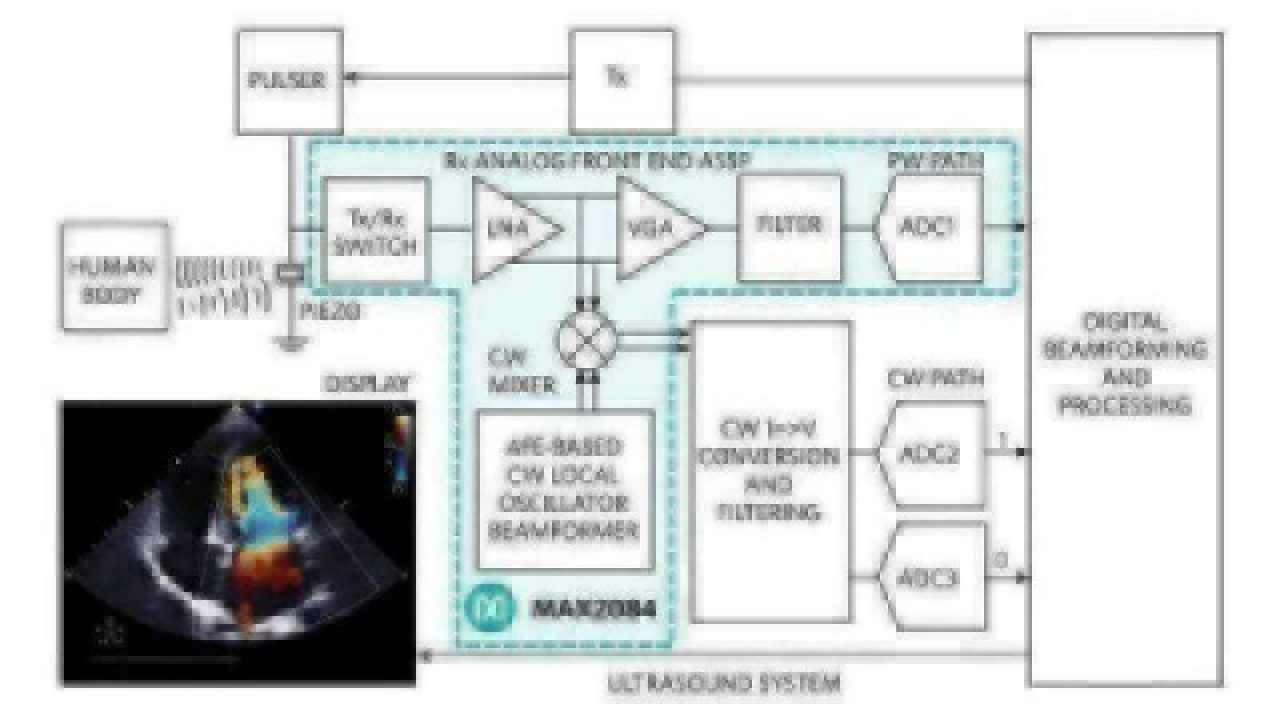Ultrasound Imaging Gets High-Performance Design - EE Times Asia